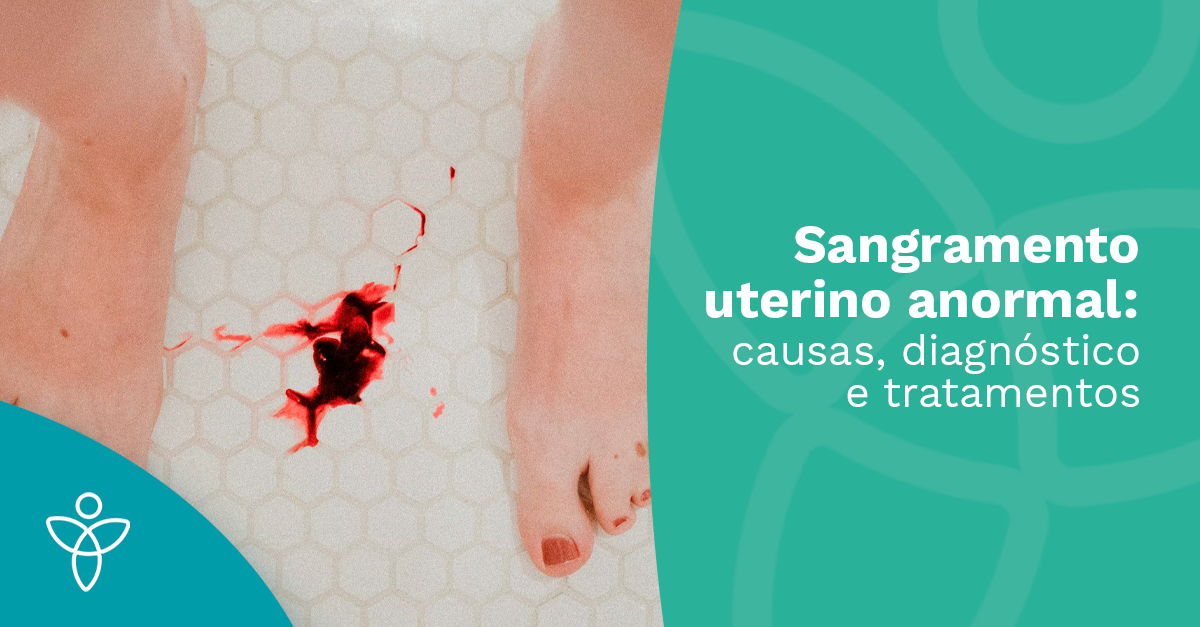 Sangramento uterino anormal: causas, diagnóstico e tratamentos