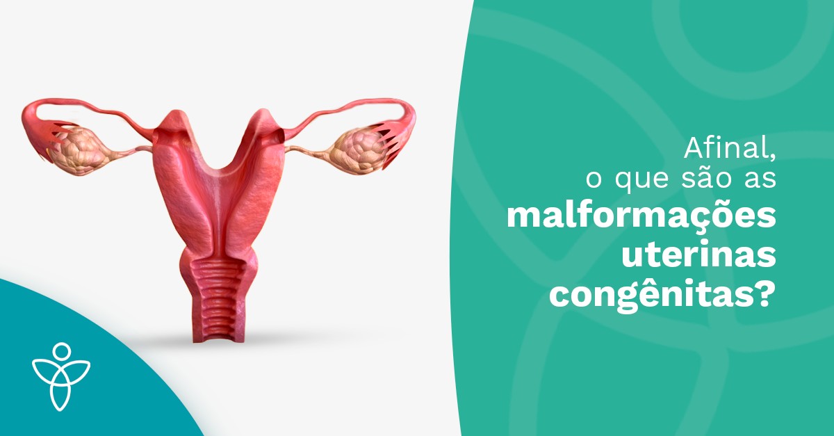 Afinal, o que são as malformações uterinas congênitas?