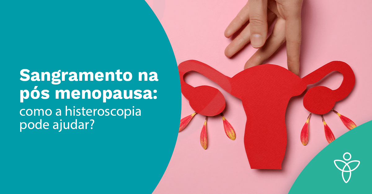 Sangramento na pós-menopausa: como a histeroscopia pode ajudar?