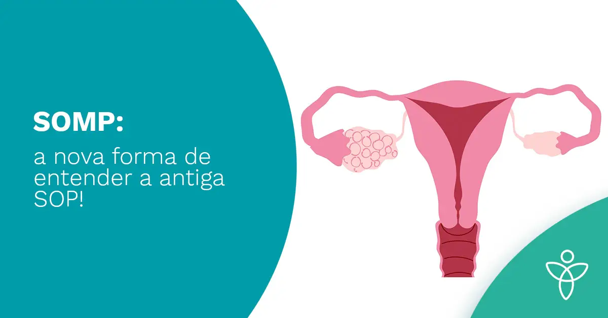  SOMP: a nova forma de entender a antiga SOP 